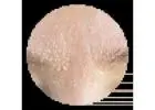 Dry Skin Treatment | Results Laser Online
