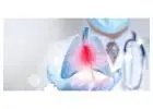 Expert Care for Lung Cancer Singapore Patients