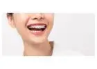 Perfect Your Teen’s Smile with Expert Braces in Singapore