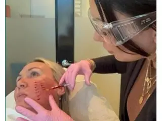 Best Dermal Fillers treatment in Hoppers Crossing Best Dermal Fillers treatment in Hoppers Crossing