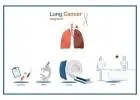 Top Specialists for Advanced Lung Cancer Treatment in Singapore