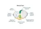 Fast Knee Relief: Effective Surgery for Meniscus Tear