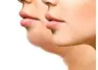The Best Non-Surgical Methods for Double Chin Removal