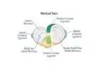 Relieve Knee Pain with Medial Meniscus Tear Surgery