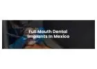 Full Mouth Dental Implants in Mexico with Teeth Savers