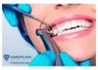 Dentists Veneers in Diamond Bar for a Brighter, Flawless Smile