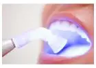 Get a Confident Smile with Teeth Whitening Melbourne Now
