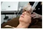 Fractionated CO2 Laser for Acne Scars & Pigmentation in Altamonte Springs, Orlando, Daytona Beac