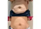 Best Body Contouring clinic in Berwick