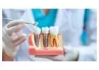 Fontana Emergency Dentist for Implants and Family Dentistry