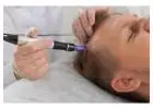 Best Microneedling Clinic in Burleigh Heads