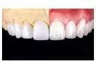 Get Your Perfect Smile by Treating from Dentist in Tijuana