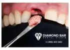 Trusted Dentist in Diamond Bar, CA for Family Dental Care Today