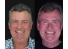 Best Dental Implants in Connolly