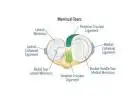 What Happens After a Knee Meniscal Tear Is Diagnosed