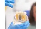 Periodontist in Tijuana – Advanced Gum Care for a Healthier Smile