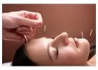 Acupuncture NYC | Sports Medicine & Dry Needling | Pain Management | Bryant Park Midtown