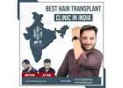 affordable hair transplant 