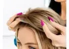 Expert Hair Loss Solutions Dallas